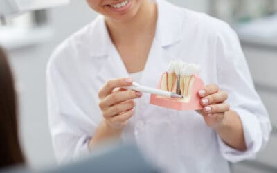 ¿Cuáles son los tipos de implantes dentales y qué materiales utilizan?