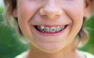Cuidados para el tratamiento de ortodoncia en niños