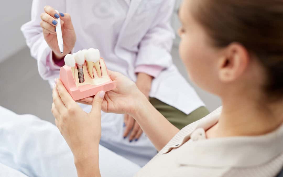 Cuidados postoperatorios de los implantes dentales: Tips para una pronta recuperación